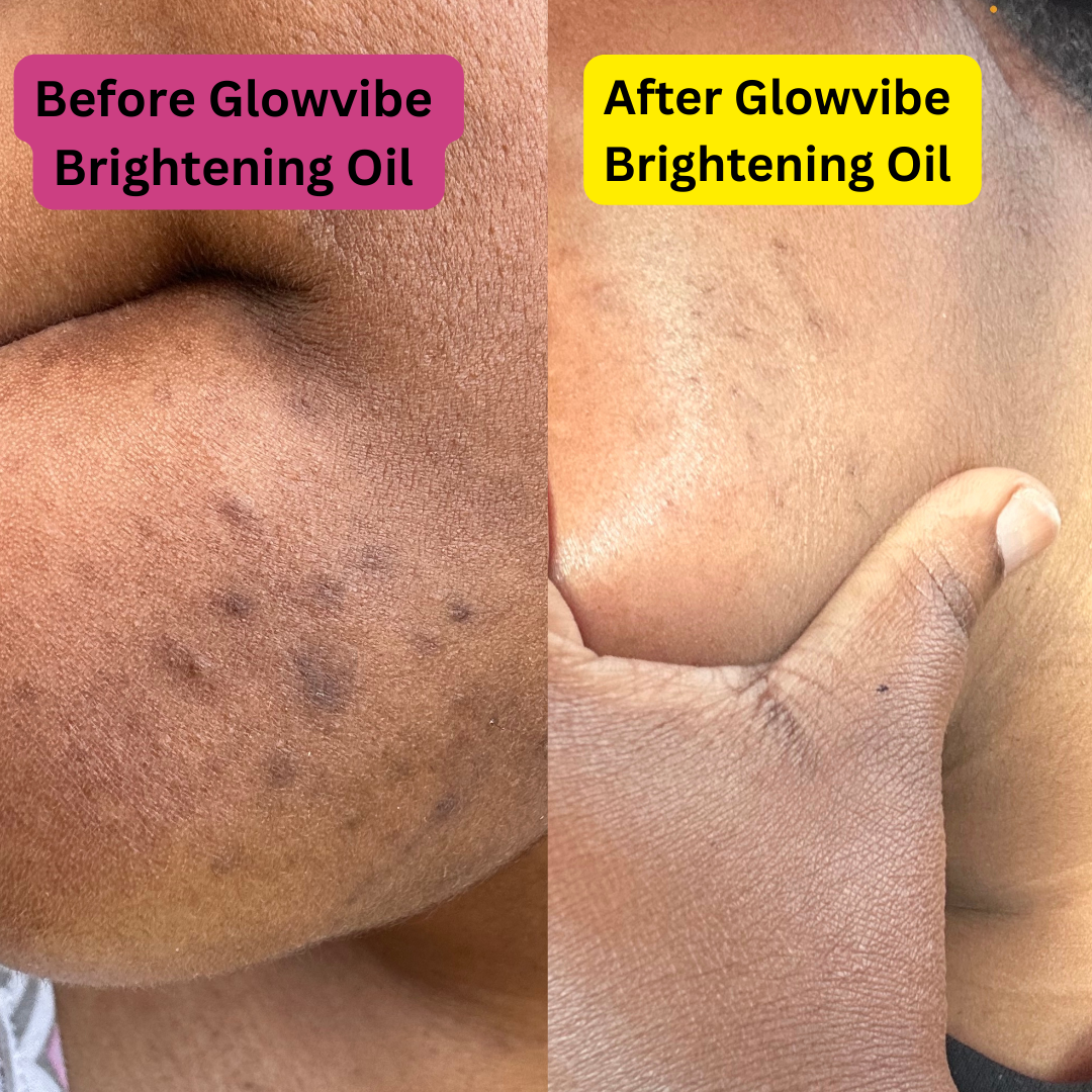 GlowVibe Brightening Oil - Your Solution for Radiant, Even-Toned Skin ✨